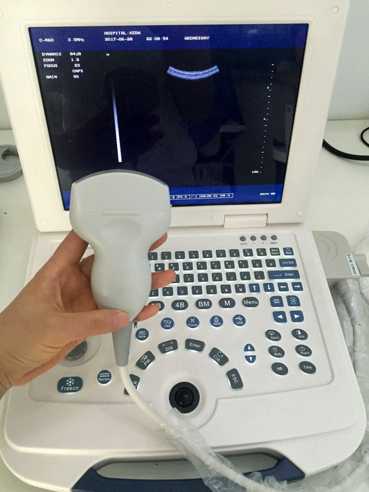 Full Digitalveterinary Ultrasound system Ultrasound Veterinary Ultrasound Machine