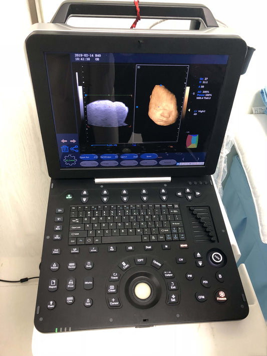 professional laptop 4D color ultrasound scanner MSLCU64