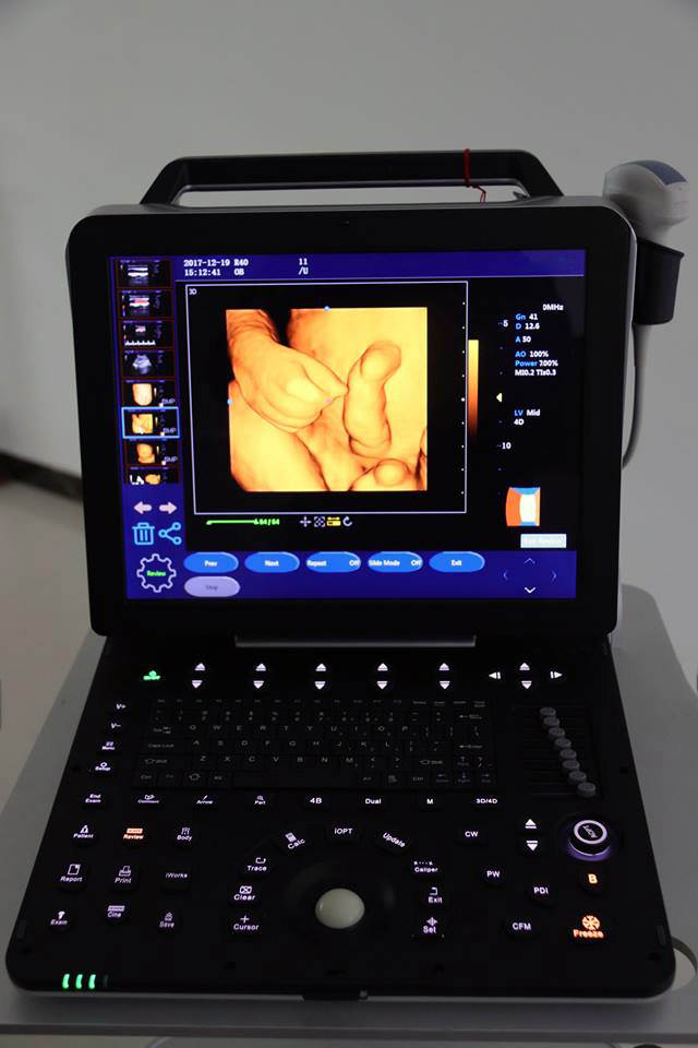 professional laptop 4D color ultrasound scanner MSLCU64