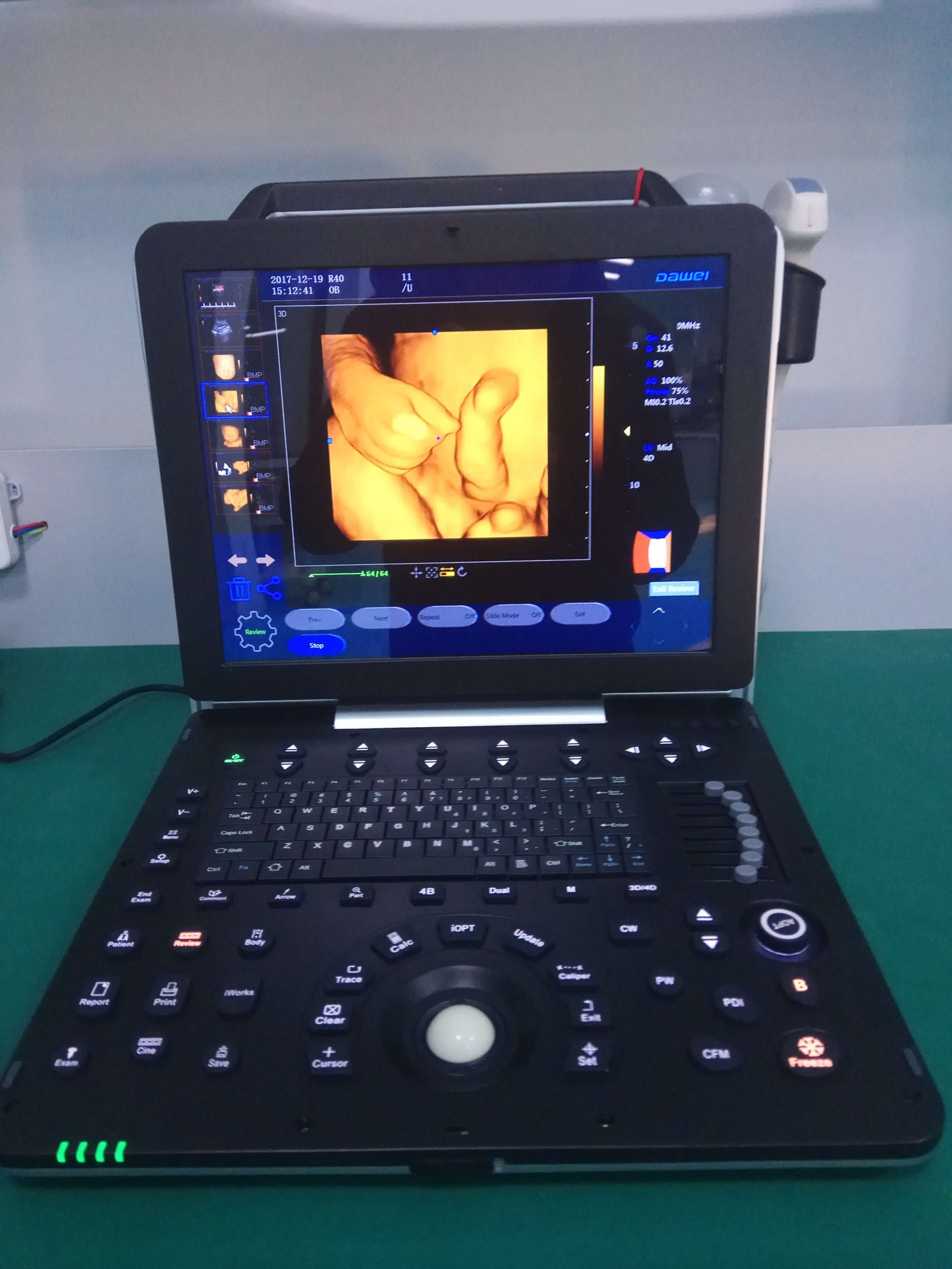 professional laptop 4D color ultrasound scanner MSLCU64