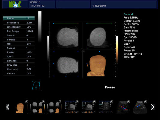 Portable color dopples ultrasound scanner cansonic MSLCU28PLUS