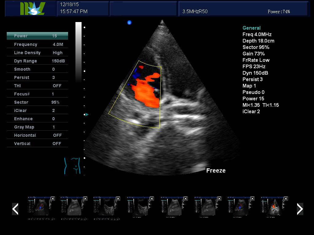 Portable color dopples ultrasound scanner cansonic MSLCU28PLUS