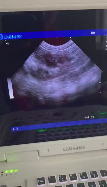 Full Digitalveterinary Ultrasound system Ultrasound Veterinary Ultrasound Machine